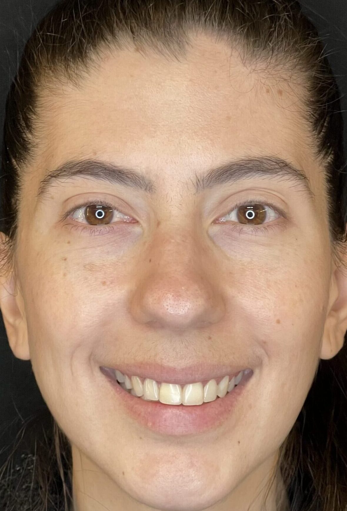 Antes Marina Antes Marina