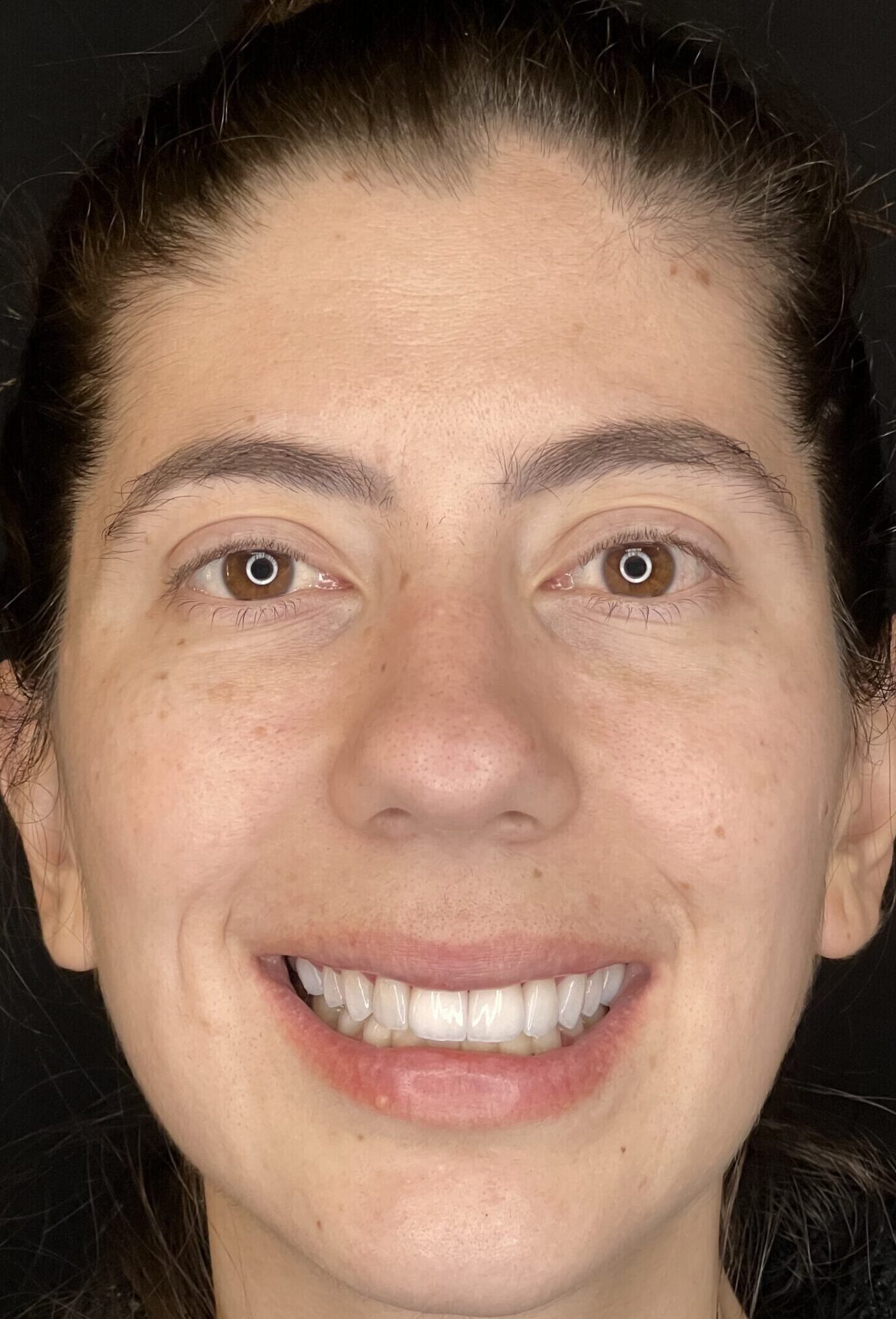 Depois Marina Depois Marina